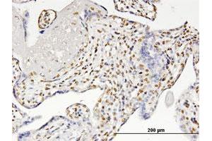 Immunoperoxidase of monoclonal antibody to RUNX2 on formalin-fixed paraffin-embedded human placenta. (RUNX2 antibody  (AA 251-350))