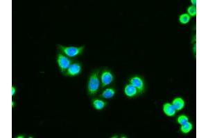 Immunofluorescent staining of HT29 cells using anti-AK1 mouse monoclonal antibody (ABIN2452270). (Adenylate Kinase 1 antibody)