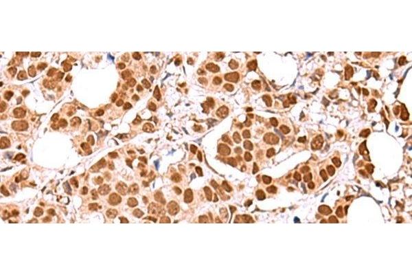 RCOR3 antibody