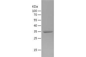 Western Blotting (WB) image for Macrophage Migration Inhibitory Factor (Glycosylation-Inhibiting Factor) (MIF) (AA 2-115) protein (His-IF2DI Tag) (ABIN7123822) (MIF Protein (AA 2-115) (His-IF2DI Tag))