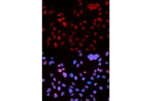 Immunofluorescence analysis of U2OS cells using Phospho-p53-S9 antibody (ABIN5969929). (p53 antibody  (pSer9))