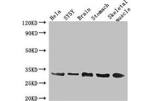 Western Blot Positive WB detected in: Hela whole cell lysate, SH-SY5Y whole cell lysate, Mouse brain tissue, Mouse stomach tissue, Mouse skeletal muscle tissue All lanes: GJB3 antibody at 3 μg/mL Secondary Goat polyclonal to rabbit IgG at 1/50000 dilution Predicted band size: 31 kDa Observed band size: 31 kDa (Connexin 31 antibody  (AA 211-270))