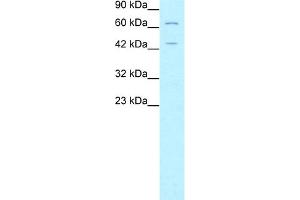 WB Suggested Anti-FOXP3 Antibody Titration:  5. (FOXP3 antibody  (N-Term))