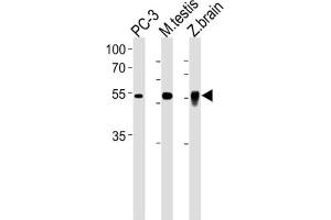 Western Blotting (WB) image for anti-DMRT-Like Family A2 (DMRTA2) antibody (ABIN3001241) (DMRTA2 antibody)
