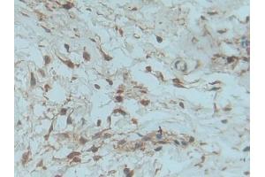 Used in DAB staining on fromalin fixed paraffin- embedded kidney tissue (PDGF-BB Homodimer (AA 82-190) antibody)