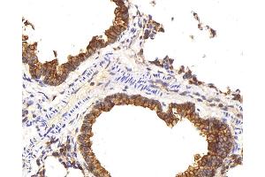 Immunohistochemistry analysis of paraffin-embedded mouse lung using CK-8 Polyclonal Antibody at dilution of 1:200. (KRT8 antibody)