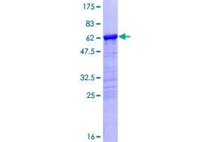 NUBP1 Protein (AA 1-320) (GST tag)
