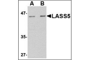 Western blot analysis of LASS5 in rat brain tissue lysate with this product at (A) 1 and (B) 2 μg/ml. (LASS5 antibody  (N-Term))