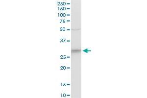 CYB5R3 polyclonal antibody (A01), Lot # AUL1060606QCS1. (CYB5R3 antibody  (AA 1-301))