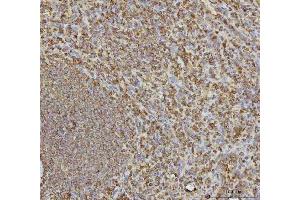 IHC analysis of VPS53 using anti-VPS53 antibody (ABIN7599731). (VPS53 antibody  (AA 11-699))