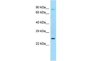 Western Blotting (WB) image for anti-Sex Hormone Binding Globulin (SHBG) (N-Term) antibody (ABIN2789332) (SHBG antibody  (N-Term))