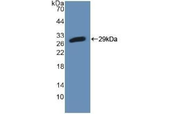PFKP anticorps  (AA 247-473)