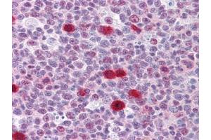 Immunohistochemistry (IHC) image for anti-TSC22 Domain Family, Member 3 (TSC22D3) (AA 1-98) antibody (ABIN614600) (TSC22D3 antibody  (AA 1-98))