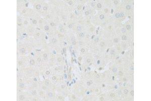 Immunohistochemistry of paraffin-embedded Rat liver using KAT2A Polyclonal Antibody at dilution of 1:100 (40x lens). (KAT2A antibody)
