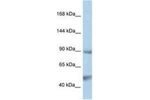 Image no. 1 for anti-Protein tyrosine Phosphatase, Non-Receptor Type 3 (PTPN3) (AA 106-155) antibody (ABIN6747346) (PTPN3 antibody  (AA 106-155))