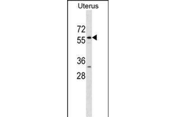 LEMD2 antibody  (N-Term)