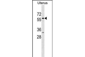 LEMD2 Antibody (N-term) (ABIN1538922 and ABIN2838288) western blot analysis in Uterus tissue lysates (35 μg/lane). (LEMD2 antibody  (N-Term))