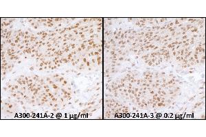 Immunohistochemistry (IHC) image for anti-Replication Protein A1, 70kDa (RPA1) (AA 350-400) antibody (ABIN7453556) (RPA1 antibody  (AA 350-400))