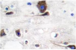 Image no. 1 for anti-Neuregulin 1 (NRG1) antibody (ABIN265466) (Neuregulin 1 antibody)