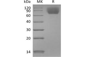 Western Blotting (WB) image for Neurotrophic tyrosine Kinase, Receptor, Type 3 (NTRK3) protein (His tag) (ABIN7320924) (NTRK3 Protein (His tag))