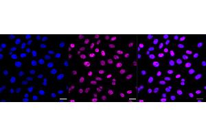 Immunocytochemical staining of HepG2 cells with SF3B1 antibody (ABIN7800424), 1:1,000).