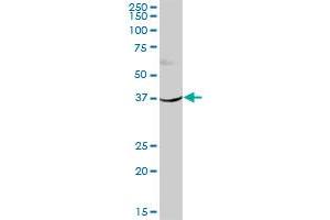 HSD11B2 MaxPab polyclonal antibody. (HSD11B2 antibody  (AA 1-405))
