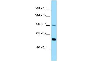 WB Suggested Anti-CSF2RB Antibody Titration: 1. (CD131 antibody  (C-Term))