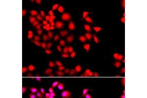 Immunofluorescence analysis of A549 cells using STXBP2 Polyclonal Antibody (STXBP2 antibody)