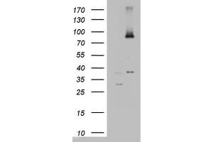 Western Blotting (WB) image for anti-ATP-Binding Cassette, Sub-Family D (Ald), Member 1 (ABCD1) (AA 508-745) antibody (ABIN2715621)