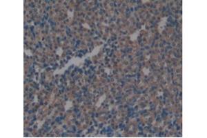 Detection of ARG in Rat Kidney Tissue using Monoclonal Antibody to Arginase (ARG) (ARG antibody  (AA 1-323))