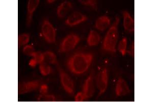 Immunofluorescence staining of methanol-fixed HeLa cells using RELA (phospho S468) polyclonal antibody . (NF-kB p65 antibody  (pSer468))