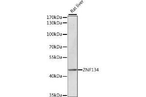 Western blot analysis of extracts of rat liver, using ZNF134 antibody (ABIN7271455) at 1:1000 dilution. (ZNF134 antibody  (AA 100-180))
