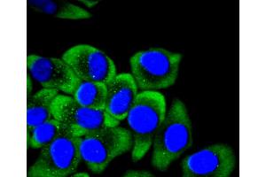 HepG2 cells were fixed in paraformaldehyde, permeabilized with 0. (KRT14 antibody)
