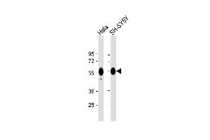 Western Blot at 1:1000 dilution Lane 1: Hela whole cell lysate Lane 2: SH-SY5Y whole cell lysate Lysates/proteins at 20 ug per lane. (GOPC antibody)