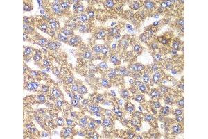 Immunohistochemistry of paraffin-embedded Rat liver using UGDH Polyclonal Antibody at dilution of 1:100 (40x lens). (UGDH antibody)