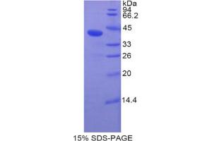SDS-PAGE analysis of Human BMP10 Protein. (BMP10 Protein)