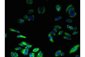 Immunofluorescent analysis of HepG2 cells using ABIN7173151 at dilution of 1:100 and Alexa Fluor 488-congugated AffiniPure Goat Anti-Rabbit IgG(H+L) (TMEM217 antibody  (AA 150-211))
