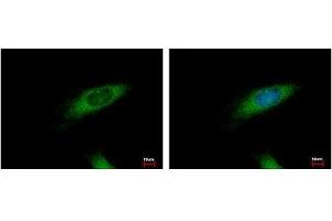 Image no. 3 for anti-Huntingtin Interacting Protein 1 Related (HIP1R) (N-Term) antibody (ABIN1494032) (HIP1R antibody  (N-Term))