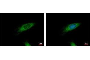 Image no. 3 for anti-Huntingtin Interacting Protein 1 Related (HIP1R) (N-Term) antibody (ABIN1494032) (HIP1R antibody  (N-Term))