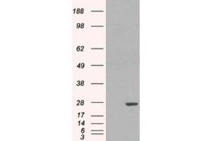 Western Blotting (WB) image for anti-Glutathione S-Transferase pi 1 (GSTP1) (Internal Region) antibody (ABIN2465797) (GSTP1 antibody  (Internal Region))