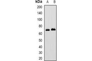 Western blot analysis of MAVS expression in HepG2 (A), MCF7 (B) whole cell lysates. (MAVS antibody)