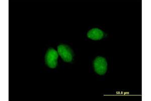 Immunofluorescence of purified MaxPab antibody to KCTD18 on HeLa cell. (KCTD18 antibody  (AA 1-426))