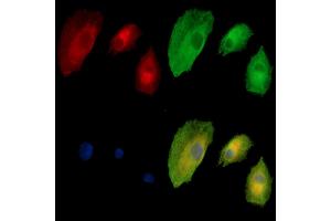 ABIN7095071 and ABIN7099127 staining  cells by IF/ICC. (TTPA antibody)
