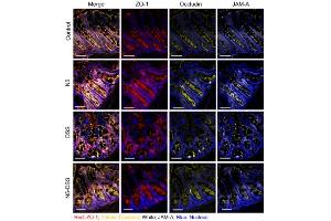 Lactobacillus johnsonii N5 improves the intestinal barrier tight junction protein and HSP70 expressions in dextran sulfate sodium-induced colitis. (TJP1 antibody)