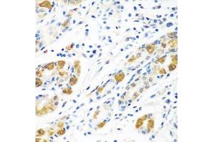 Immunohistochemistry of paraffin-embedded human stomach using BLVRB antibody. (BLVRB antibody  (AA 1-206))