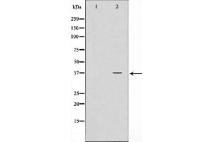 Western blot analysis on HeLa cell lysate using NPM Antibody,The lane on the left is treated with the antigen-specific peptide. (NPM1 antibody  (N-Term))