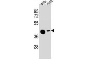 Western Blotting (WB) image for anti-Solute Carrier Family 35, Member G5 (SLC35G5) antibody (ABIN2995904)