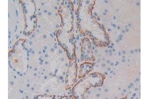 Detection of MET in Human Kidney Tissue using Polyclonal Antibody to C-Met (MET) (c-MET antibody  (AA 1092-1379))