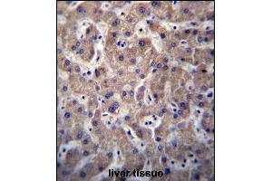 SULT1A3/SULT1A4 Antibody (N-term) (ABIN656776 and ABIN2845995) immunohistochemistry analysis in formalin fixed and paraffin embedded human liver tissue followed by peroxidase conjugation of the secondary antibody and DAB staining. (SULT1A3,SULT1A4 (AA 71-99), (N-Term) antibody)