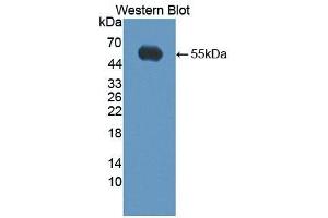 Detection of Recombinant KLK14, Human using Polyclonal Antibody to Kallikrein 14 (KLK14) (Kallikrein 14 antibody  (AA 36-267))